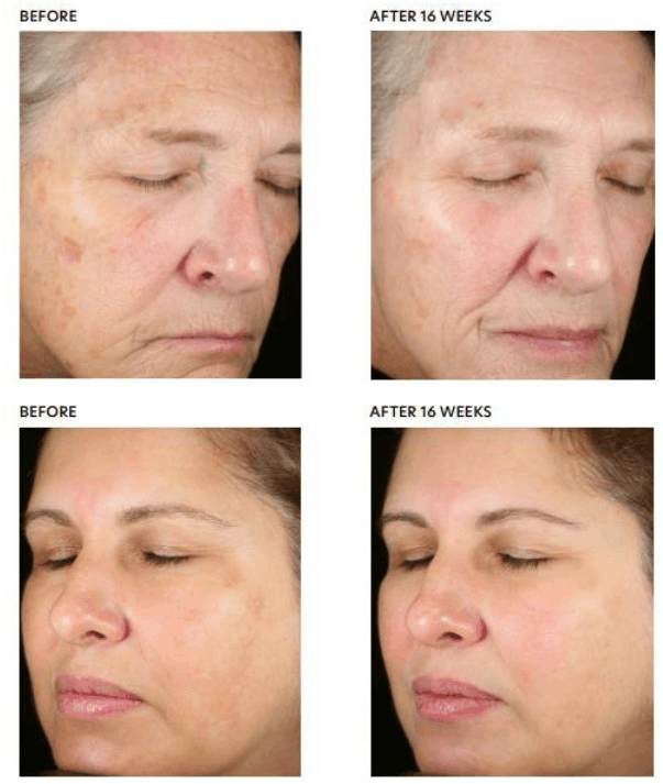 PCA Skin Pigment Gel Pro - Zaawansowane serum korygujące przebarwienia 29 ml